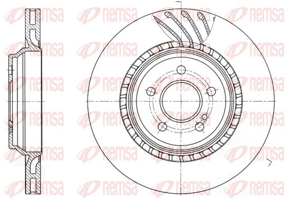 REMSA 61740.10