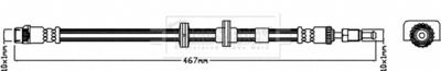 BORG & BECK BBH7965